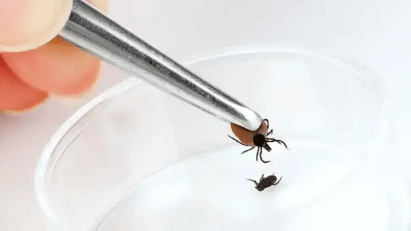 蜱虫钻入孩子头皮，家长用手抠没用才送医院，医生怒斥父母：没点常识！蜱虫很毒已经害死很多人了